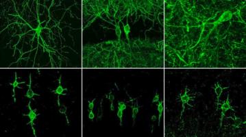 Flourescent imaging neurons